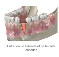 REBONE GRANULES CORTICO-CANCELLOUS UBGEN