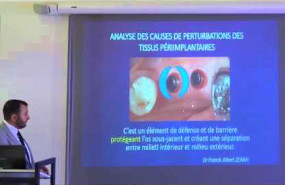 Importance du platform switching dans la pérennité de l'espace biologique périimplantaire Importance du platform switching dans la pérennité de l'espace biologique périimplantaire